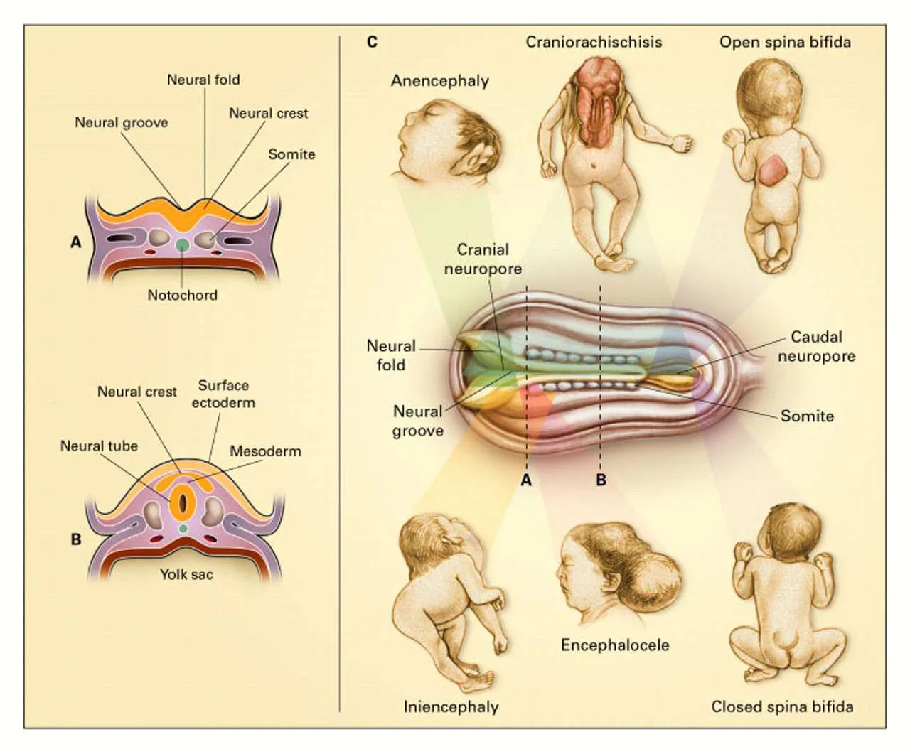 اصابات الجهاز الهضمي لحديثي الولادة