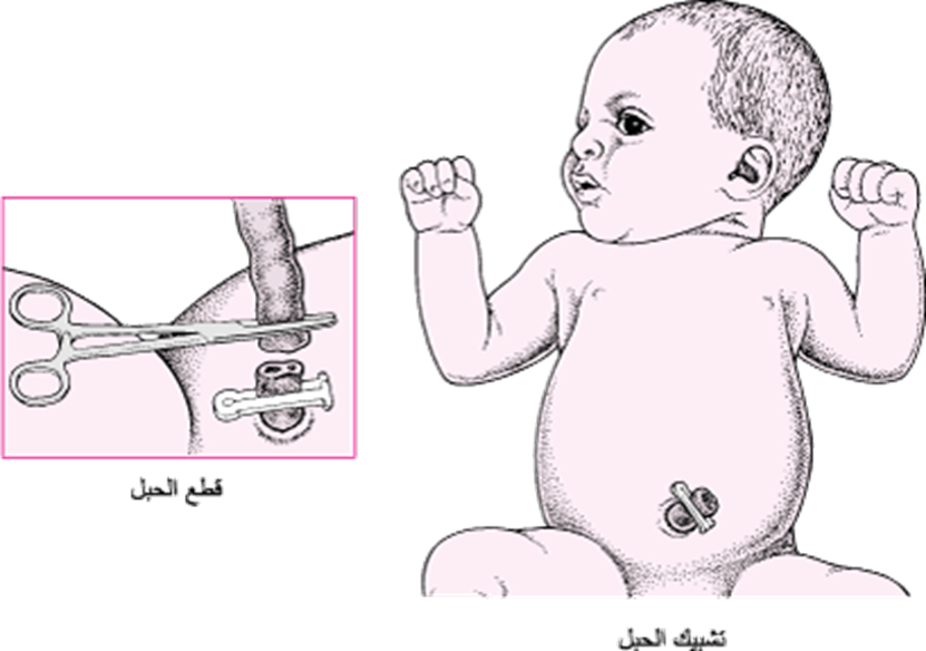 جراحة الأطفال حديثي الولادة